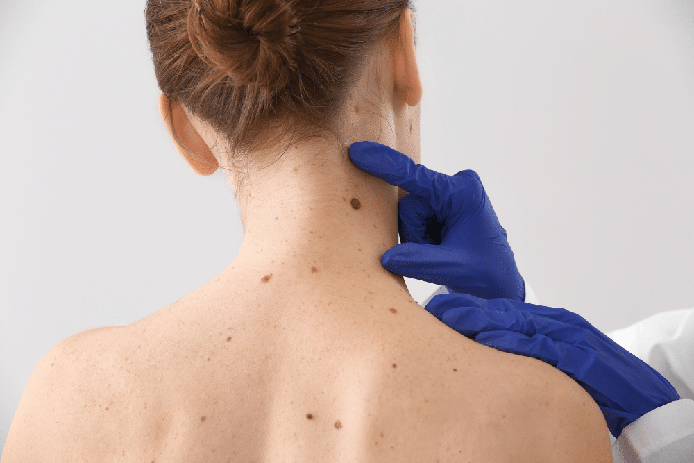 Fonte: American Society for Mohs Surgery,2023 