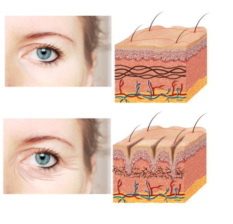 Fonte: Dermato Saúde, 2015